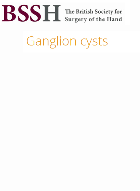 Ganglion Cysts