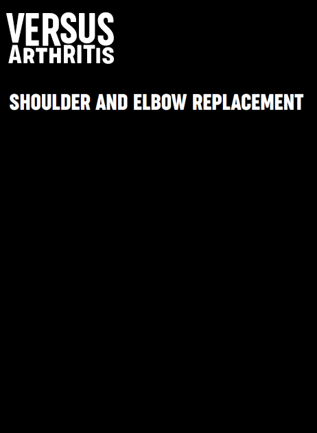 Shoulder and Elbow Joint Replacement