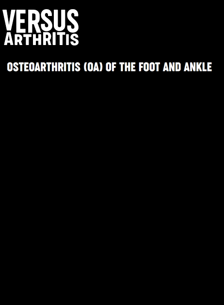 Osteoarthritis – Foot & Ankle