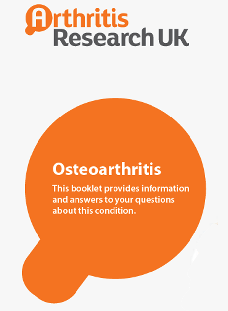 Osteoarthritis – Knee